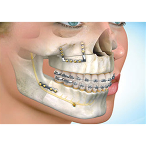 chirurgia maxillo facciale